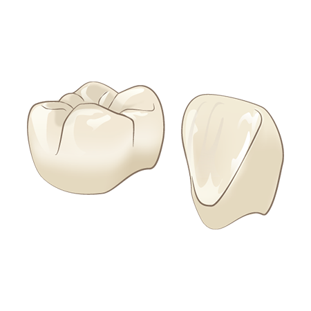 オールセラミッククラウン