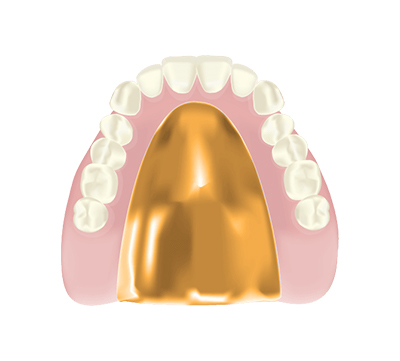 ゴールド床入れ歯